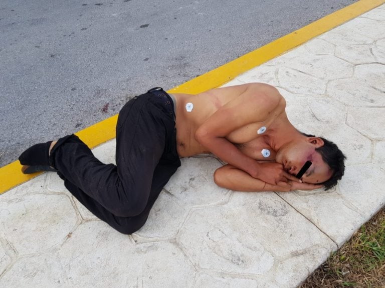 Hallan hombre con huellas de tortura; asegura que “se cayó”