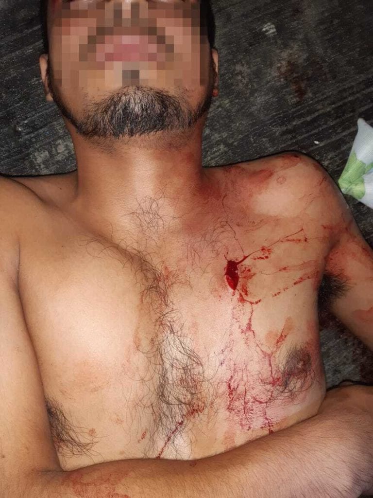 Salió apuñalados por sus amigos de parranda, en Cancún