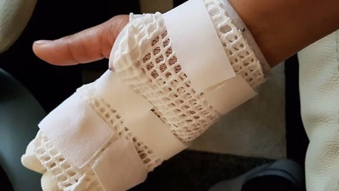 Un hombre fue detenido hoy en Cancún, acusado de golpear a una mujer y amputarle dos dedos, en Playa del Carmen