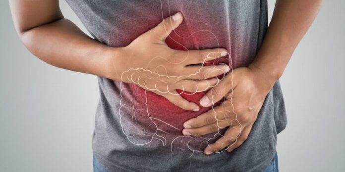 Padecen Síndrome de Intestino Irritable más del 75% de las personas en México