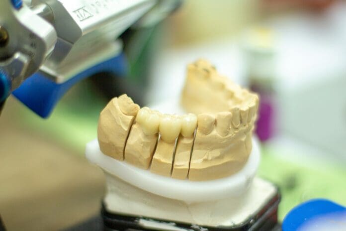 Cientos de dientes humanos caen encima de un hombre mientras reparaba una tienda