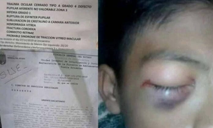 Niño karateca agrede a otro hasta casi matarlo afuera de una escuela en Chiapas