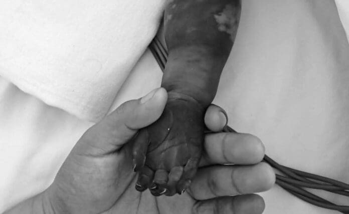 Denuncian presunta negligencia en Hospital General de Cancún; una bebé podría perder un brazo. Familia pide ayuda.