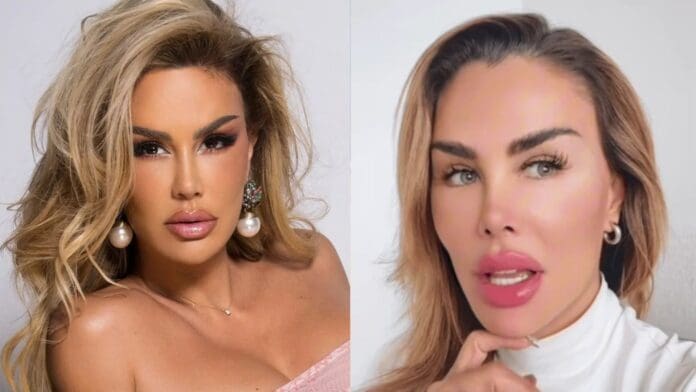 Ninel Conde cambio de ojos Ninel Conde se somete a cirugía para cambiar el color de sus ojos