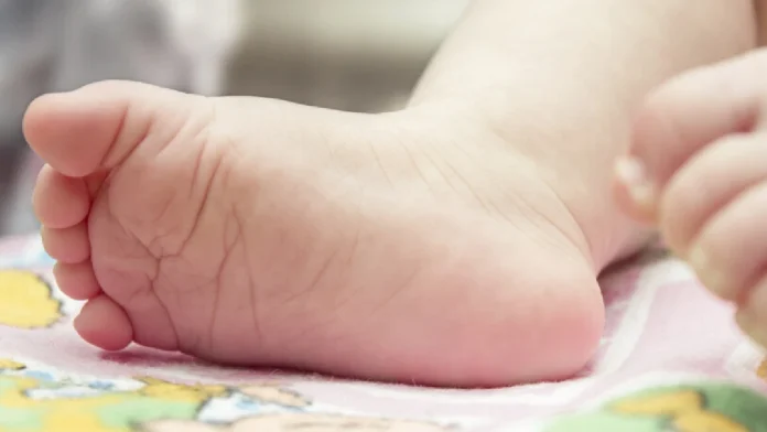 Bebé de un año muere al tragarse una pila electrónica en Monterrey, Nuevo León Bebé de un año muere al tragarse una pila electrónica en Monterrey, Nuevo León