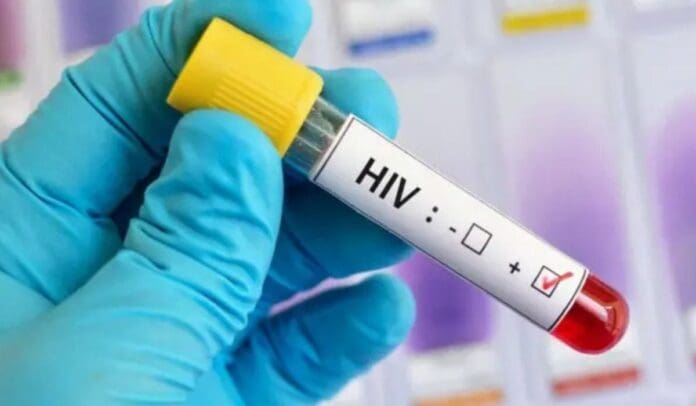 VIH revelan por qué el virus persiste en algunos pacientes