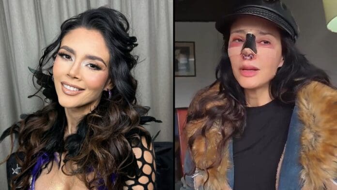 Video: Actriz Dorismar acusa a su cirujano de desfigurarle el rostro tras una rinoplastia mal hecha